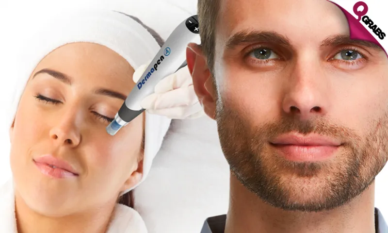Dermapen Treatments & More!